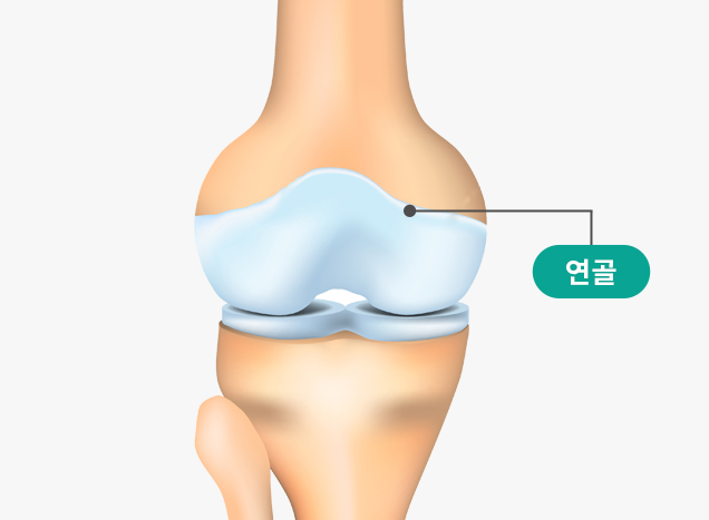 정상 무릎