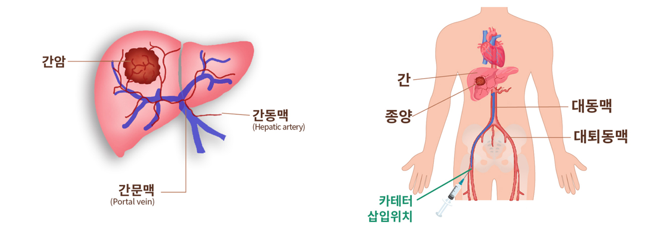 척추센터