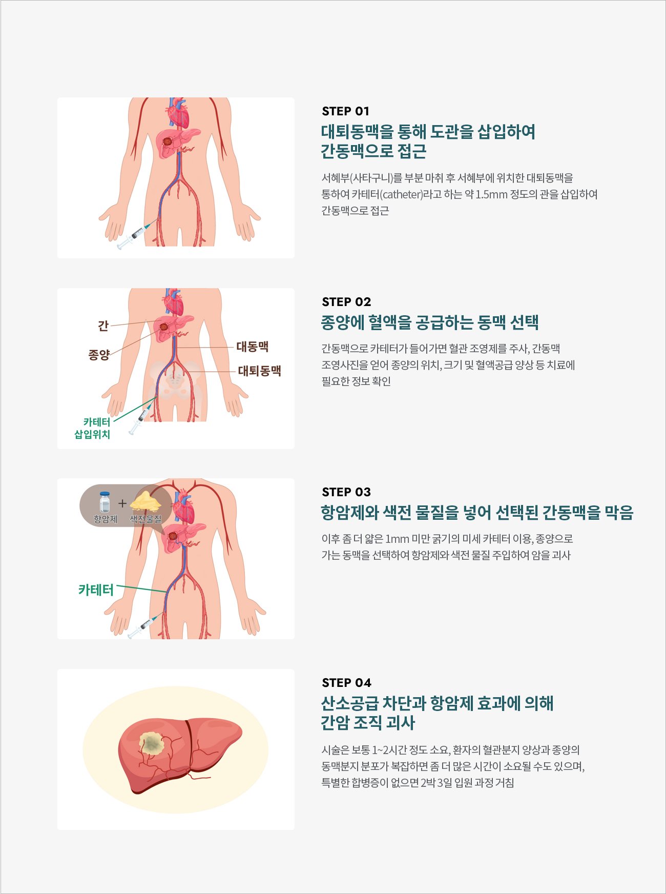 척추센터