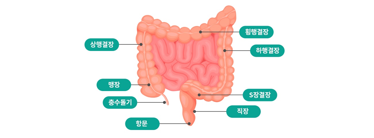 충수염 (맹장염)