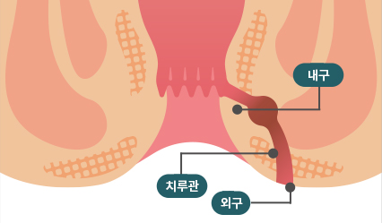 도플러 초음파 검사